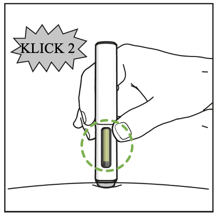 Pennan har satts in i huden. En bildtext som säger "2:a klick" visas ovan för att indikera det andra klickljudet från pennan. En grön prickad cirkel markerar fönstret som är grönt för att visa lyckad infogning.