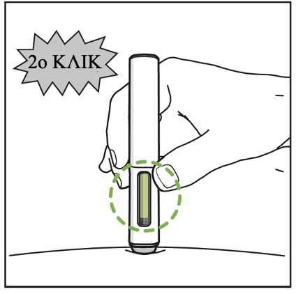 Η πένα έχει εισαχθεί στο δέρμα. Ένα μήνυμα που λέει "2ο κλικ" εμφανίζεται παραπάνω για να υποδείξει τον 2ο ήχο κλικ από το στυλό. Ένας πράσινος κύκλος με κουκκίδες επισημαίνει το παράθυρο που είναι γεμάτο πράσινο για να δείξει την επιτυχή εισαγωγή.